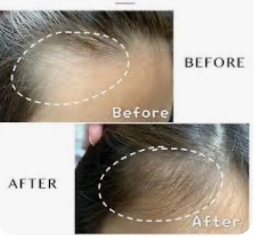 Hair growth serum 100% Organic, non-Gmo, Vegan and cruelty free